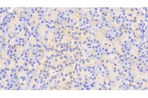 Detection of ATG16L1 in Human Pancreas Tissue using Polyclonal Antibody to Autophagy Related Protein 16 Like Protein 1 (ATG16L1) (ATG16L1 antibody  (AA 342-607))