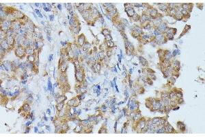 Immunohistochemistry (Paraffin-embedded Sections) (IHC (p)) image for anti-Histidine Ammonia-Lyase (HAL) antibody (ABIN7256538)