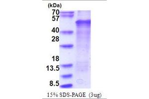 SDS-PAGE (SDS) image for LIM Homeobox Transcription Factor 1, beta (LMX1B) (AA 1-395) protein (His tag) (ABIN5853769) (LMX1B Protein (AA 1-395) (His tag))