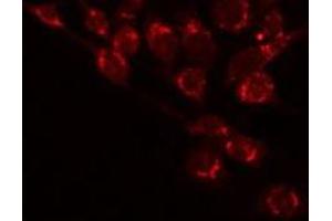 ABIN6277297 staining 293 by IF/ICC. (Betacellulin antibody  (N-Term))