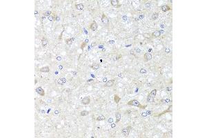 Immunohistochemistry of paraffin-embedded rat brain using IL33 antibody (ABIN5995447) at dilution of 1/100 (40x lens). (IL-33 antibody)