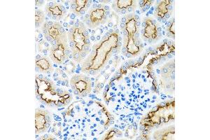 Immunohistochemistry of paraffin-embedded mouse kidney using RPS2 antibody at dilution of 1:100 (x40 lens).
