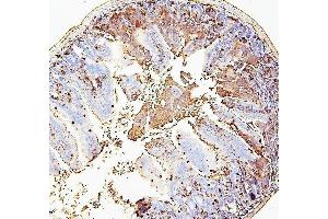 IHC analysis of RAB27A using anti-RAB27A antibody (ABIN7602714). (RAB27A antibody  (AA 98-216))