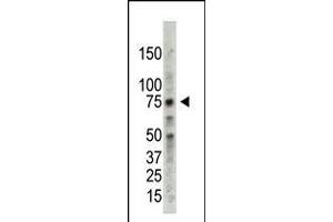 Antibody is used in Western blot to detect PRMT5 in HL60 cell lysate. (PRMT5 antibody  (C-Term))