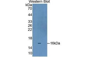 Western Blotting (WB) image for anti-Fibronectin (AA 2206-2337) antibody (ABIN1980400) (Fibronectin antibody  (AA 2206-2337))