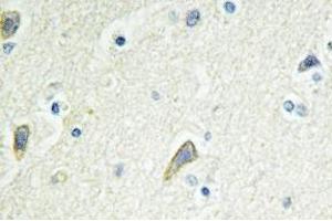 Immunohistochemistry analysis of EphB4 Antibody in paraffin-embedded human brain tissue. (EPH Receptor B4 antibody)