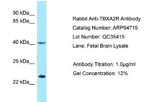 Western Blotting (WB) image for anti-Thromboxane A2 Receptor (TBXA2R) (N-Term) antibody (ABIN2789936) (TBXA2R antibody  (N-Term))
