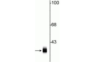 Western blot of rat cortical lysate showing specific immunolabeling of the ~ 36 kDa syntaxin 1A protein. (STX1A antibody)