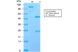 SDS-PAGE Analysis Purified NGFR Rabbit Recombinant Monoclonal Antibody (NGFR/2550R). (Recombinant NGFR antibody  (AA 281-421))