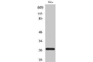 Western Blotting (WB) image for anti-P27 (pThr187) antibody (ABIN3182182)