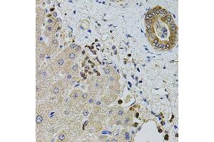 Immunohistochemistry of paraffin-embedded human liver injury using KTN1 antibody (ABIN1980246) at dilution of 1:100 (40x lens).