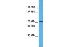 Host:  Rabbit  Target Name:  ACTN3  Sample Tissue:  Human 786-0 Whole Cell  Antibody Dilution:  1ug/ml (ACTN3 antibody  (N-Term))