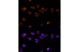 Immunofluorescence analysis of NIH/3T3 cells using PDH antibody (7432) at dilution of 1:100. (PDHA1 antibody)