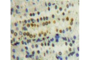 Used in DAB staining on fromalin fixed paraffin-embedded Kidney tissue (PPIE antibody  (AA 12-286))