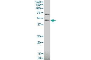 RUNX3 polyclonal antibody (A01), Lot # 070226JCSa Western Blot analysis of RUNX3 expression in HepG2 . (RUNX3 antibody  (AA 194-279))