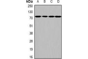 Western blot analysis of HPA2 expression in Hela (A), SKOV3 (B), mouse brain (C), rat brain (D) whole cell lysates. (Heparanase 2 antibody)