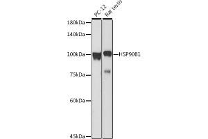 Western blot analysis of extracts of various cell lines, using HSP90B1 antibody (ABIN6130434, ABIN6142031, ABIN6142033 and ABIN7101795) at 1:1000 dilution. (GRP94 antibody  (AA 550-650))
