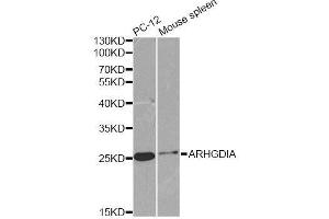 Western blot analysis of extracts of various cell lines, using ARHGDIA antibody. (ARHGDIA antibody  (AA 1-204))