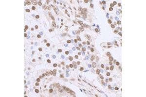 Immunohistochemistry (IHC) image for anti-Sp1 Transcription Factor (SP1) (C-Term) antibody (ABIN7458075) (SP1 antibody  (C-Term))