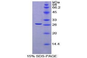 SDS-PAGE (SDS) image for Transforming Growth Factor, beta-Induced, 68kDa (TGFBI) (AA 423-632) protein (His tag) (ABIN1879772)