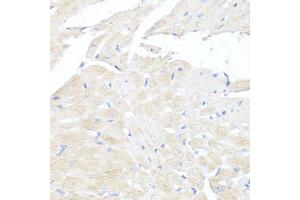 Immunohistochemistry of paraffin-embedded mouse heart using FGFR2 antibody. (FGFR2 antibody  (AA 1-100))