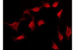 ABIN6269289 staining NIH-3T3 by IF/ICC. (BCAR1 antibody  (Internal Region))