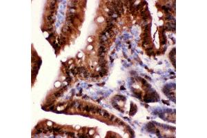 Anti-Caspase3 antibody, IHC(P) IHC(P): Mouse Intestine Tissue (Caspase 3 antibody  (AA 67-175))