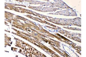 IHC analysis of CHRNA5 using anti-CHRNA5 antibody . (CHRNA5 antibody  (N-Term))