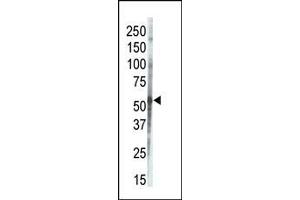 Western blot analysis of anti-CK1g3 Pab in placenta lysate. (CSNK1G3 antibody  (C-Term))