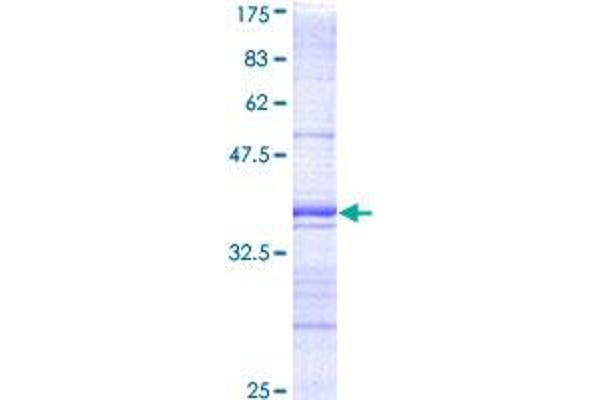 DAP Kinase 1 Protein (AA 1211-1310) (GST tag)