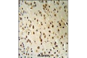 TARSL2 Antibody (C-term) (R) IHC analysis in formalin fixed and paraffin embedded human brain tissue followed by peroxidase conjugation of the secondary antibody and DAB staining. (TARSL2 antibody  (C-Term))