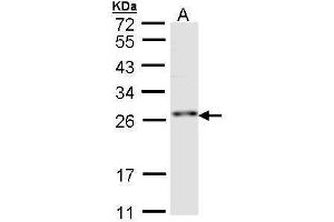 WB Image Sample (30 ug of whole cell lysate) A:Hep G2 , 12 % SDS PAGE antibody diluted at 1:1000 (RNF114 antibody)