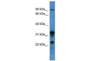 Western Blot showing F8 antibody used at a concentration of 1-2 ug/ml to detect its target protein. (Factor VIII antibody  (C-Term))