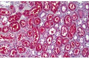 Anti-ATP6V1B2 antibody IHC staining of human kidney, tubules. (ATP6V1B2 antibody)