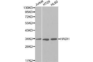 Western blot analysis of extracts of various cell lines, using HADH antibody (ABIN5970434) at 1/1000 dilution.