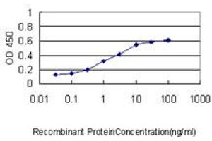 Detection limit for recombinant GST tagged PIM1 is approximately 0. (PIM1 antibody  (AA 1-100))