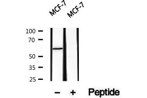Western blot analysis of extracts of MCF7 cells, using PKLR antibody. (PKLR antibody  (Internal Region))