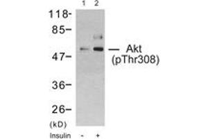 Western blot analysis of extracts from 293 cells treated with Insulin, using Akt (Phospho-Thr308) Antibody. (AKT1 antibody  (pThr308))