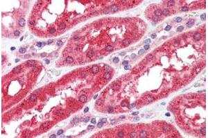 Human Kidney (formalin-fixed, paraffin-embedded) stained with FGFR4 antibody ABIN462303 followed by biotinylated anti-mouse IgG secondary antibody ABIN481714, alkaline phosphatase-streptavidin and chromogen. (FGFR4 antibody)
