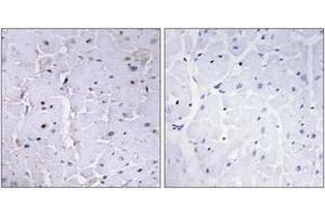 Immunohistochemistry analysis of paraffin-embedded human heart, using Pin1 (Phospho-Ser16) Antibody.
