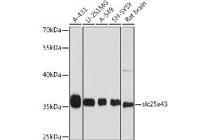 Western blot analysis of extracts of various cell lines, using slc25a43 Rabbit pAb (ABIN6133407, ABIN6147932, ABIN6147933 and ABIN6214950) at 1:1000 dilution. (SLC25A43 antibody  (AA 1-100))