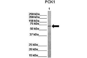 Western Blotting (WB) image for anti-phosphoenolpyruvate Carboxykinase 1 (Soluble) (PCK1) (Middle Region) antibody (ABIN2777602)