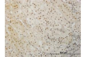 Immunoperoxidase of monoclonal antibody to LHX1 on formalin-fixed paraffin-embedded human adrenal gland. (LHX1 antibody  (AA 1-100))