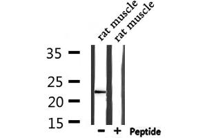 Western blot analysis of extracts from rat muscle, using CD3E Antibody.