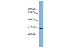 Image no. 1 for anti-Chromosome 11 Open Reading Frame 57 (C11orf57) (AA 107-156) antibody (ABIN6744127) (C11orf57 antibody  (AA 107-156))