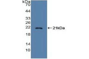 Stathmin 1 antibody  (AA 2-149)