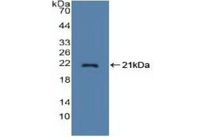 Detection of Recombinant STMN1, Human using Polyclonal Antibody to Stathmin 1 (STMN1) (Stathmin 1 antibody  (AA 2-149))
