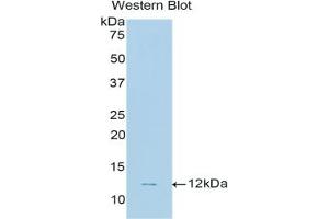 Detection of Recombinant CNP, Human using Polyclonal Antibody to C-Type Natriuretic Peptide (CNP) (NPPC antibody  (AA 33-125))