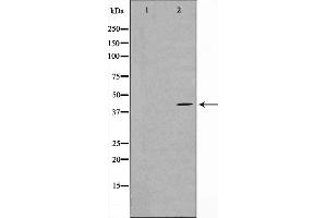Western blot analysis on COLO205 cell lysate using MAPK3 Antibody,The lane on the left is treated with the antigen-specific peptide. (MAPKAP Kinase 3 antibody  (C-Term))