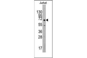 Western blot analysis of anti-MAPK4 Antibody (C-term) in Jurkat cell line lysates (35ug/lane).
